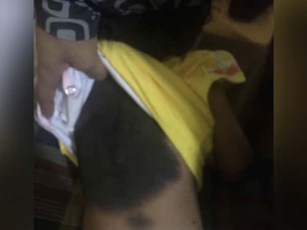 A Child Needs Treatment Costs