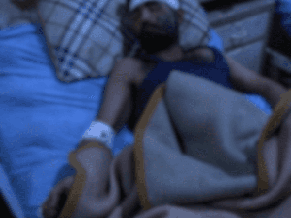 management costs after a head injury