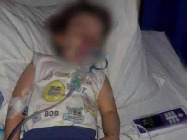Treatment expenses for a child