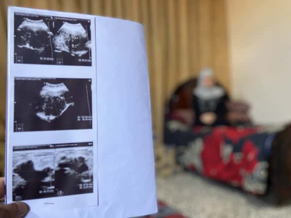 Nahed needs treatment as soon as possible!