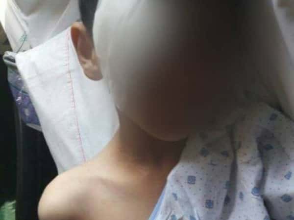 A child in need for treatment