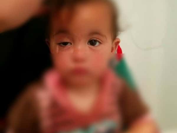 Female kid in need for a surgery
