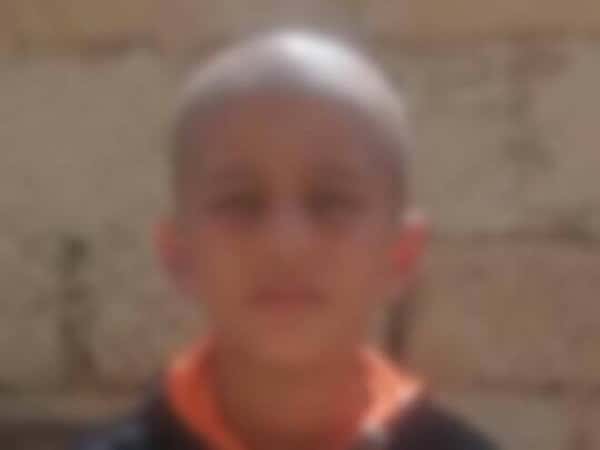 Child suffers from leukemia