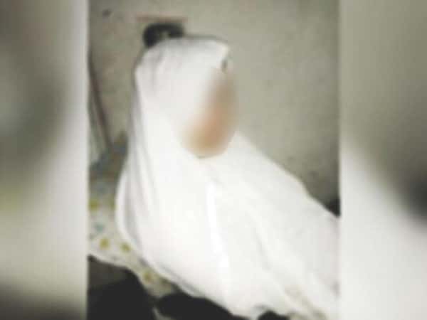 A Divorced Woman with Brain Hemorrhage