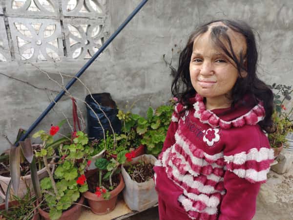 مأوى مهدوم ومعاناة طفلة