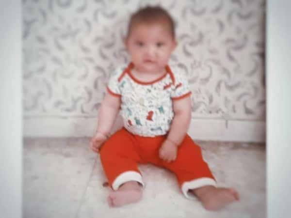 Qadriya, a girl with congenital malformation
