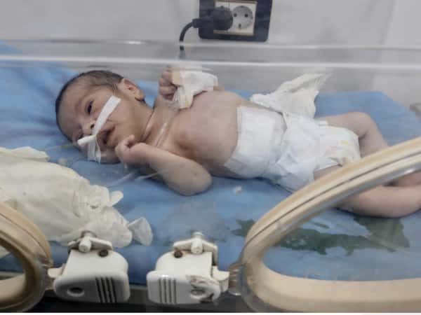 محمّد رضيع يصارع قصور القلب