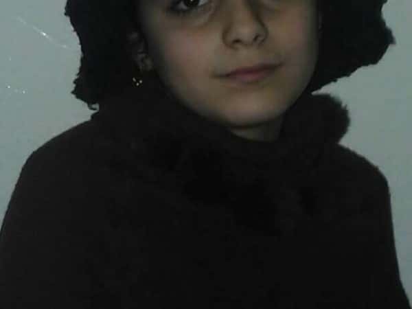 10 years old with maxillary problems