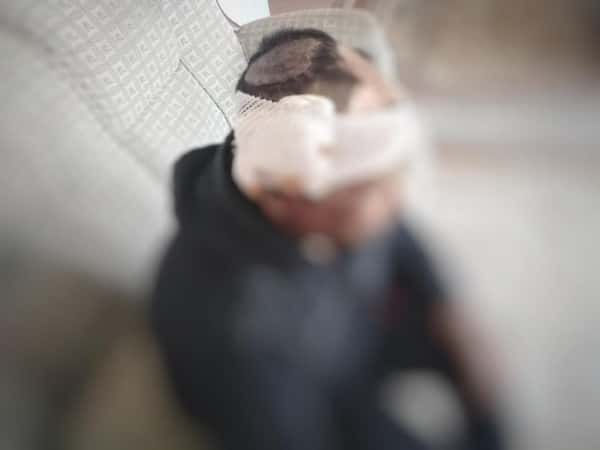 Ibrahim with dermatological disease needs a surgery