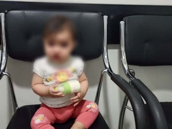 مريم تعاني من شفة أرنبية وبحاجة مساعدتكم للتخلص منها