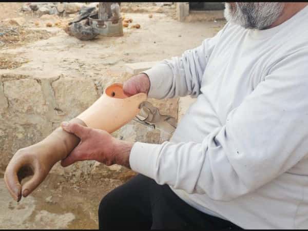 The war injury robbed him of his strength