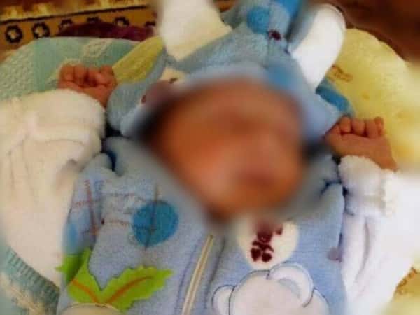 Treatment expenses for a child