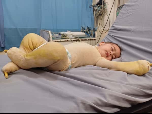 Nazir needs donations to get treatment