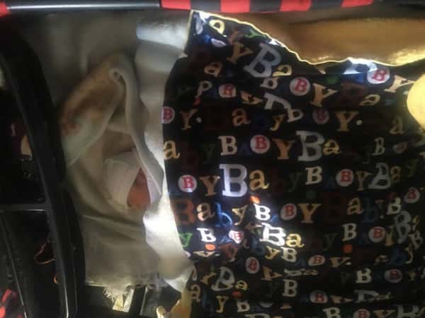 A female needs cesarean section