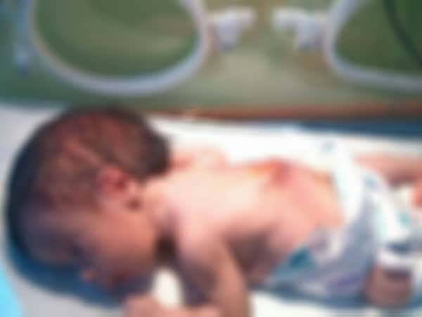 infant need treatment costs