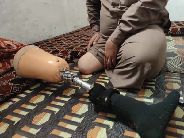 A landmine devastated this family.