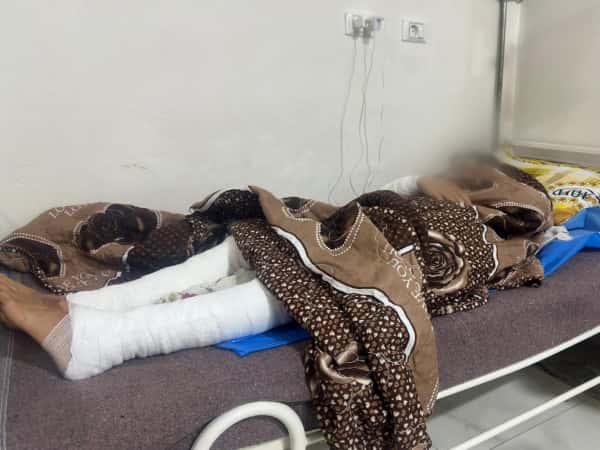 A fire in their tent almost killed Amani