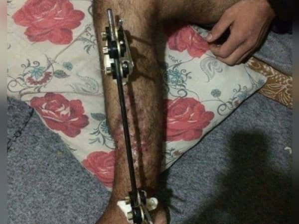 an injured man in need for treatment expenses