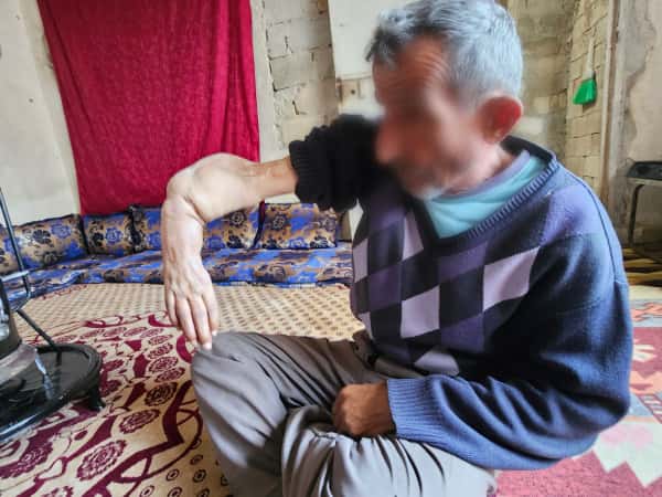 يدٌ شلّتها الحرب.. وقلبٌ أثقله فقدُ الأبناء