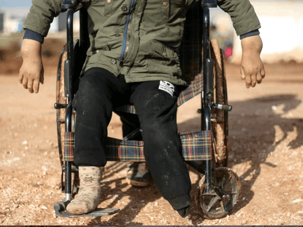 A child needs a wheelchair