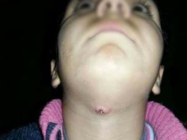 A child in need of surgery
