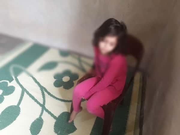 طفلة حلمها الوحيد أن تبتسم دون خجل من منظر فمها