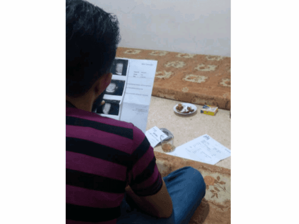 A man needs a varicocele surgery