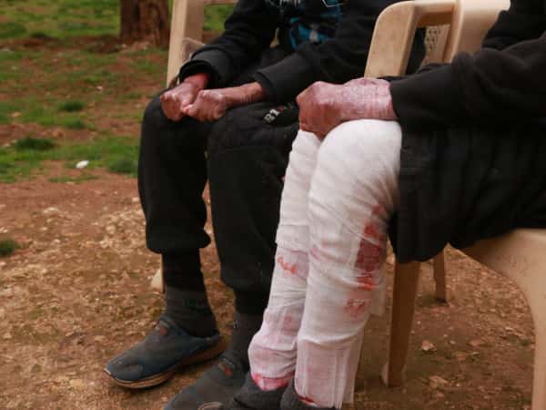 الكفالات الإنسانية