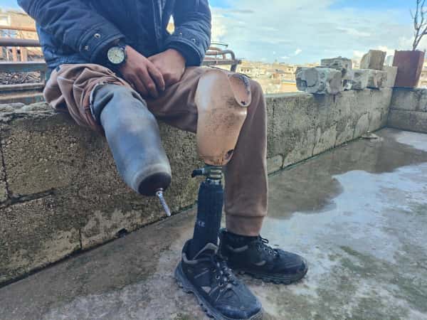 إصابة أنهكت الجسد والروح