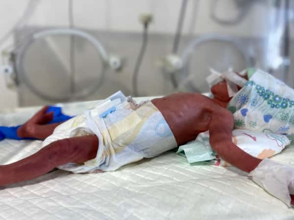 Mustafa is a premature baby that needs your support for his lungs to develop