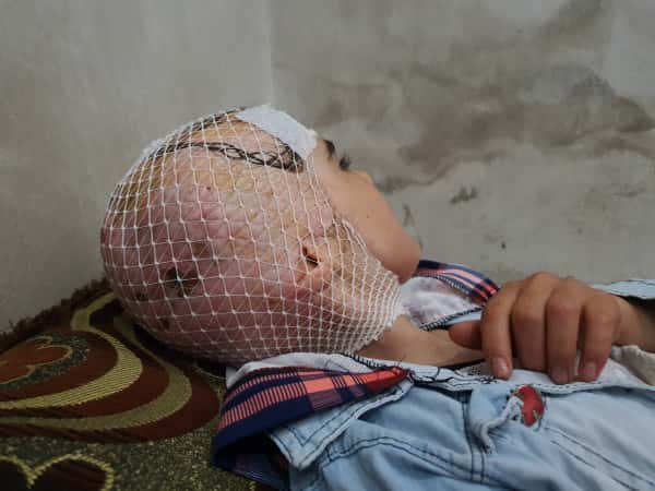 Fatima needs your help to calm her pain!