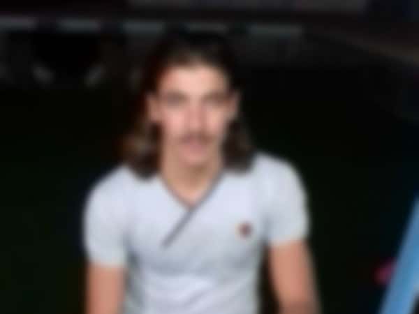 Young man needing a lens impant