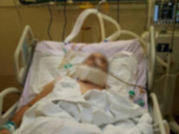 A man injured in his mandible and needs an artificial mandible .
