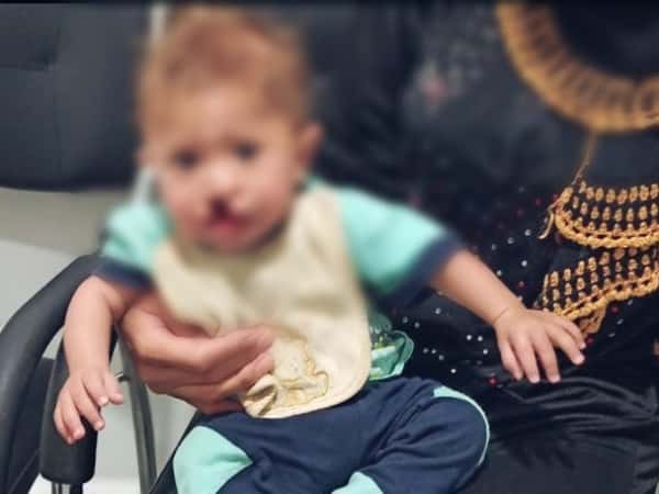 طفل عمره سنة وُلد بشفة أرنب وسقف حلق مفتوح ويُعاني من فتاق في الحالب بحاجة عملية بأقصى سرعة