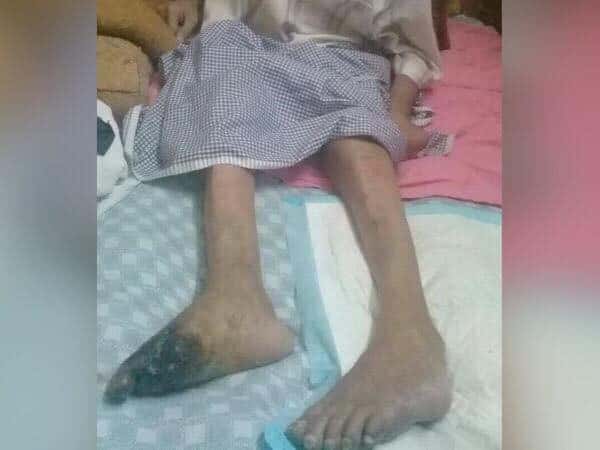A Patient Needs Treatment Expenses