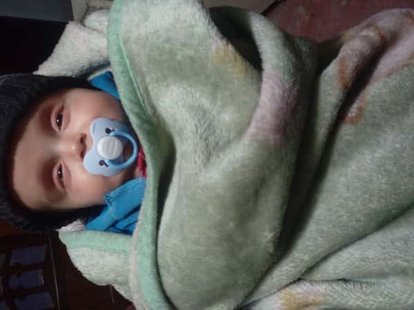 A kid with hemiplegia and hydrocephalus