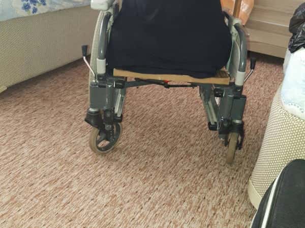 Young lady with amputated lower limbs