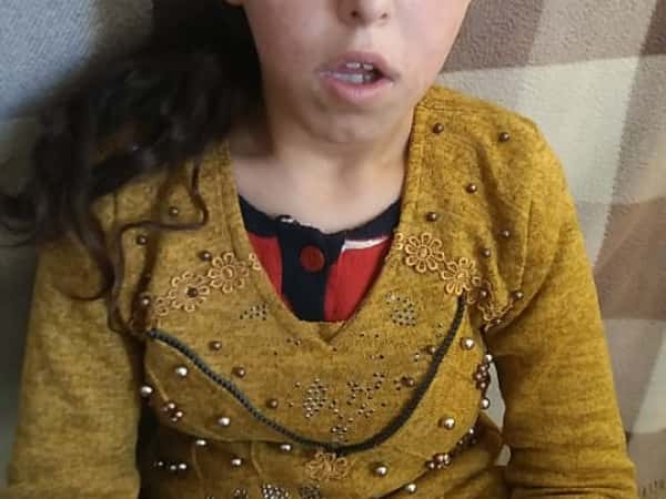 Subhia is an orphan child who needs your support