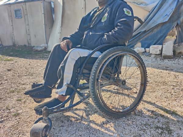 His right eye hangs in the balance.