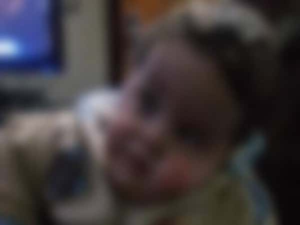 Child need treatment costs