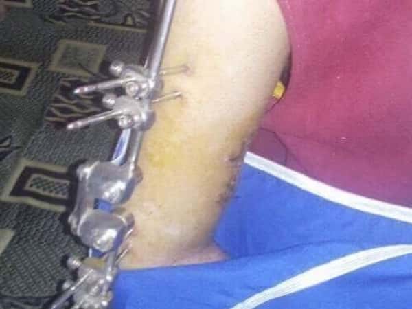 Young man needing urgent surgery
