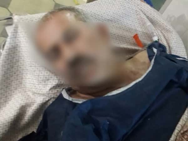 توقفت كليته عن العمل وبحاجة تدخل جراحي