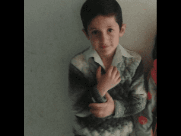 Surgery for a kid with difficulty breathing