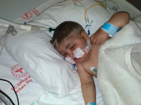 Hisham suffers from Griscelli Syndrome