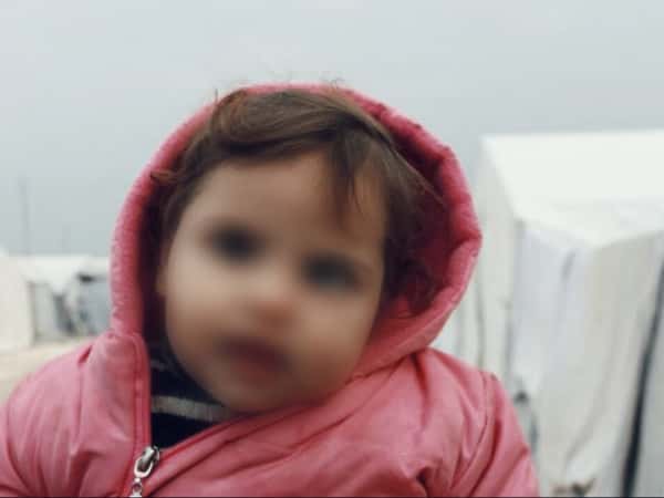 child with cerebral atrophy
