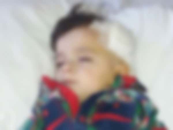 Child suffering from brain water