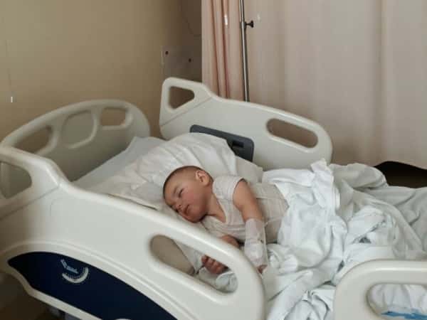 An infant with a skull break