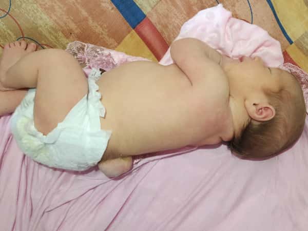 The little girl Gaza needs urgent surgery!