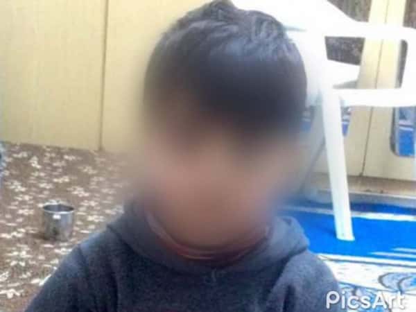 Child needs eye glasses