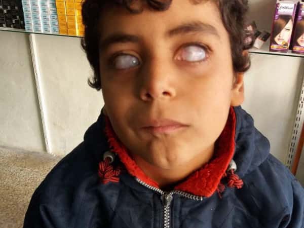 A child in need for financial aid